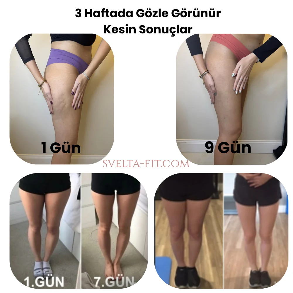 Svelta-Fit™ Bacak İncelten Masaj Aleti